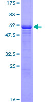 ASPA Protein - 12.5% SDS-PAGE of human ASPA stained with Coomassie Blue