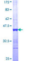 ASPA Protein - 12.5% SDS-PAGE Stained with Coomassie Blue.