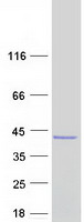 ASPA Protein - Purified recombinant protein ASPA was analyzed by SDS-PAGE gel and Coomassie Blue Staining