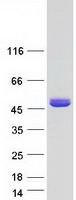 ASPA Protein - Purified recombinant protein ASPA was analyzed by SDS-PAGE gel and Coomassie Blue Staining