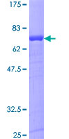 Aspartate Aminotransferase Protein - 12.5% SDS-PAGE of human GOT1 stained with Coomassie Blue