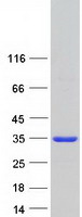 ASPDH Protein - Purified recombinant protein ASPDH was analyzed by SDS-PAGE gel and Coomassie Blue Staining
