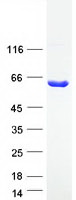 ASPG Protein - Purified recombinant protein ASPG was analyzed by SDS-PAGE gel and Coomassie Blue Staining