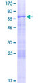 ASPHD1 Protein - 12.5% SDS-PAGE of human ASPHD1 stained with Coomassie Blue