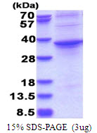 ASPHD1 Protein