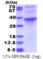ASPHD1 Protein