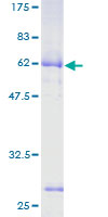 ASPHD2 Protein - 12.5% SDS-PAGE of human LOC57168 stained with Coomassie Blue