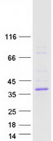 ASPHD2 Protein - Purified recombinant protein ASPHD2 was analyzed by SDS-PAGE gel and Coomassie Blue Staining