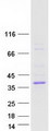 ASPHD2 Protein - Purified recombinant protein ASPHD2 was analyzed by SDS-PAGE gel and Coomassie Blue Staining