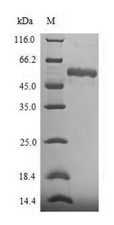 ASPN / Asporin Protein - (Tris-Glycine gel) Discontinuous SDS-PAGE (reduced) with 5% enrichment gel and 15% separation gel.