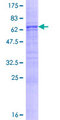 ASPN / Asporin Protein - 12.5% SDS-PAGE of human ASPN stained with Coomassie Blue