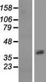 ASPRV1 / SASPase Protein - Western validation with an anti-DDK antibody * L: Control HEK293 lysate R: Over-expression lysate