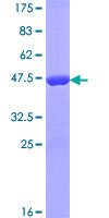 ASPRV1 / SASPase Protein - 12.5% SDS-PAGE of human FLJ25084 stained with Coomassie Blue