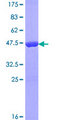 ASPRV1 / SASPase Protein - 12.5% SDS-PAGE of human FLJ25084 stained with Coomassie Blue