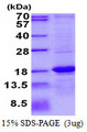 ASPRV1 / SASPase Protein