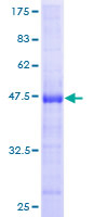 ASRGL1 Protein - 12.5% SDS-PAGE of human ASRGL1 stained with Coomassie Blue