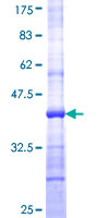 ASRGL1 Protein - 12.5% SDS-PAGE Stained with Coomassie Blue.