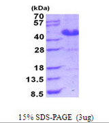 ASRGL1 Protein