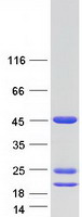 ASRGL1 Protein - Purified recombinant protein ASRGL1 was analyzed by SDS-PAGE gel and Coomassie Blue Staining