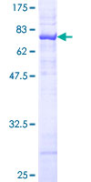 ASS1 / ASS Protein - 12.5% SDS-PAGE of human ASS stained with Coomassie Blue