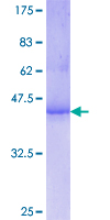 ASS1 / ASS Protein - 12.5% SDS-PAGE Stained with Coomassie Blue.