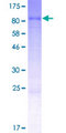 ASTE1 Protein - 12.5% SDS-PAGE of human ASTE1 stained with Coomassie Blue