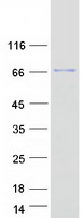 ASTE1 Protein - Purified recombinant protein ASTE1 was analyzed by SDS-PAGE gel and Coomassie Blue Staining