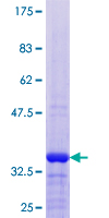 ASXL1 Protein - 12.5% SDS-PAGE of human ASXL1 stained with Coomassie Blue