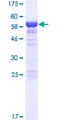 ASZ1 / Orf3 Protein - 12.5% SDS-PAGE of human ASZ1 stained with Coomassie Blue