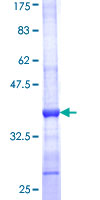 ASZ1 / Orf3 Protein - 12.5% SDS-PAGE Stained with Coomassie Blue.