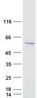 ASZ1 / Orf3 Protein - Purified recombinant protein ASZ1 was analyzed by SDS-PAGE gel and Coomassie Blue Staining