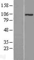 ATAC1 / ZZZ3 Protein - Western validation with an anti-DDK antibody * L: Control HEK293 lysate R: Over-expression lysate