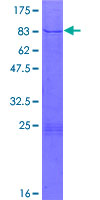 ATAC1 / ZZZ3 Protein - 12.5% SDS-PAGE of human ZZZ3 stained with Coomassie Blue