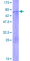 ATAD2 Protein - 12.5% SDS-PAGE of human ATAD2 stained with Coomassie Blue