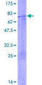 ATAD2 Protein - 12.5% SDS-PAGE of human ATAD2 stained with Coomassie Blue