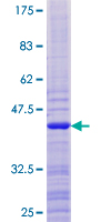 ATAD4 Protein - 12.5% SDS-PAGE of human ATAD4 stained with Coomassie Blue
