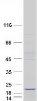 ATAD4 Protein - Purified recombinant protein PRR15L was analyzed by SDS-PAGE gel and Coomassie Blue Staining