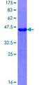 ATCAY / CLAC Protein - 12.5% SDS-PAGE Stained with Coomassie Blue.
