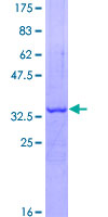 ATE1 Protein - 12.5% SDS-PAGE Stained with Coomassie Blue.