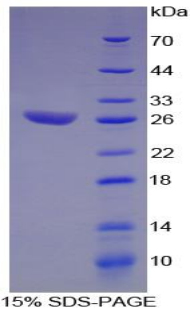 ATF1 Protein - Recombinant Activating Transcription Factor 1 By SDS-PAGE