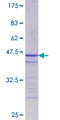ATF2 Protein - 12.5% SDS-PAGE Stained with Coomassie Blue.