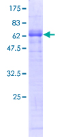 ATF4 Protein - 12.5% SDS-PAGE of human ATF4 stained with Coomassie Blue