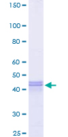 ATF4 Protein - 12.5% SDS-PAGE Stained with Coomassie Blue.
