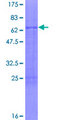 ATF5 Protein - 12.5% SDS-PAGE of human ATF5 stained with Coomassie Blue