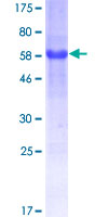 ATF6 Protein - 12.5% SDS-PAGE of human ATF6 stained with Coomassie Blue