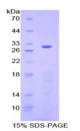 ATF6 Protein - Recombinant Activating Transcription Factor 6 By SDS-PAGE