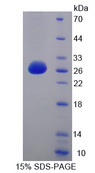ATF7 Protein - Recombinant  Activating Transcription Factor 7 By SDS-PAGE