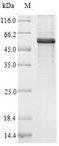 ATG14 Protein - (Tris-Glycine gel) Discontinuous SDS-PAGE (reduced) with 5% enrichment gel and 15% separation gel.