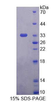 ATG16L1 / ATG16L Protein - Recombinant  Autophagy Related Protein 16 Like Protein 1 By SDS-PAGE