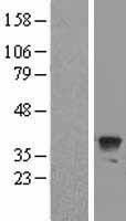 ATG3 Protein - Western validation with an anti-DDK antibody * L: Control HEK293 lysate R: Over-expression lysate